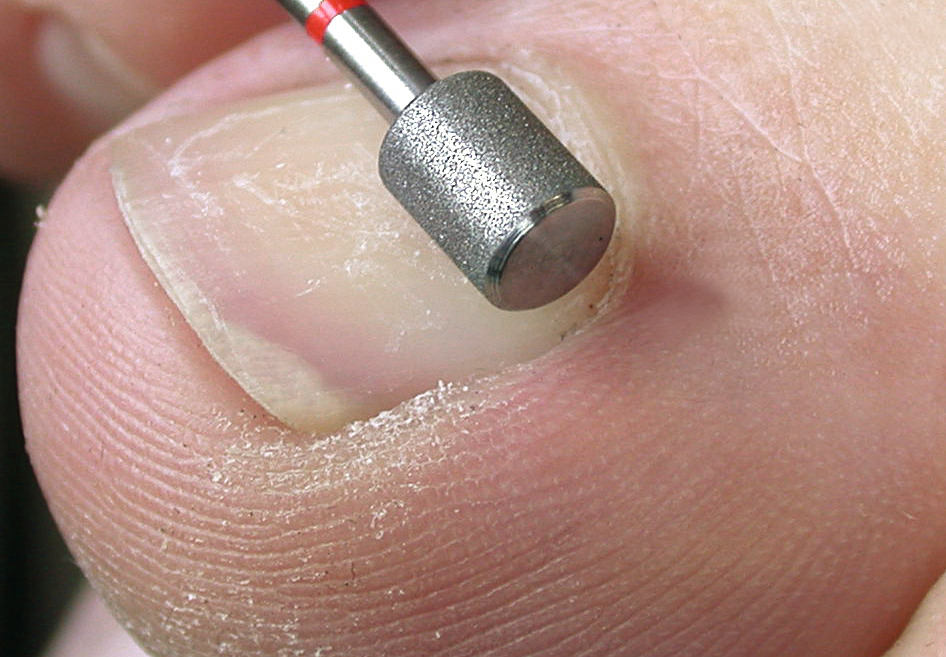 Busch Diamantschleifer SIDE Grip | Körnung fein Ø 5,5 mm