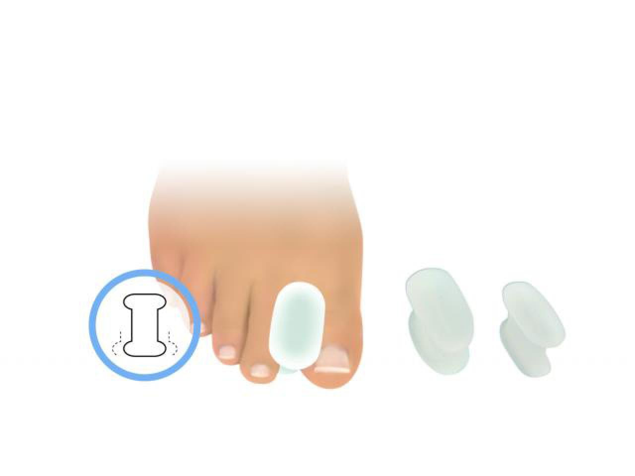 FRESCO Zehenspreizer | Zehenteiler aus Polymer Gel - dicke Form Größe: L FRESCO Zehenspreizer | Zehenteiler aus Polymer Gel - dicke Form Größe: L