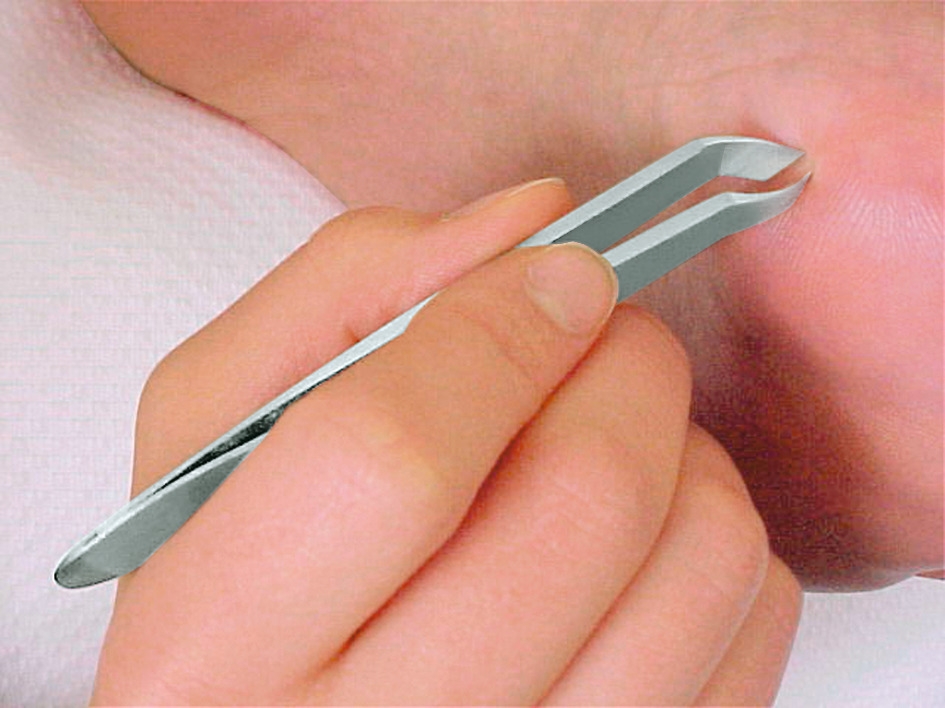 RUCK Hautzange mit Pinzettengriff, Schneide 3 mm