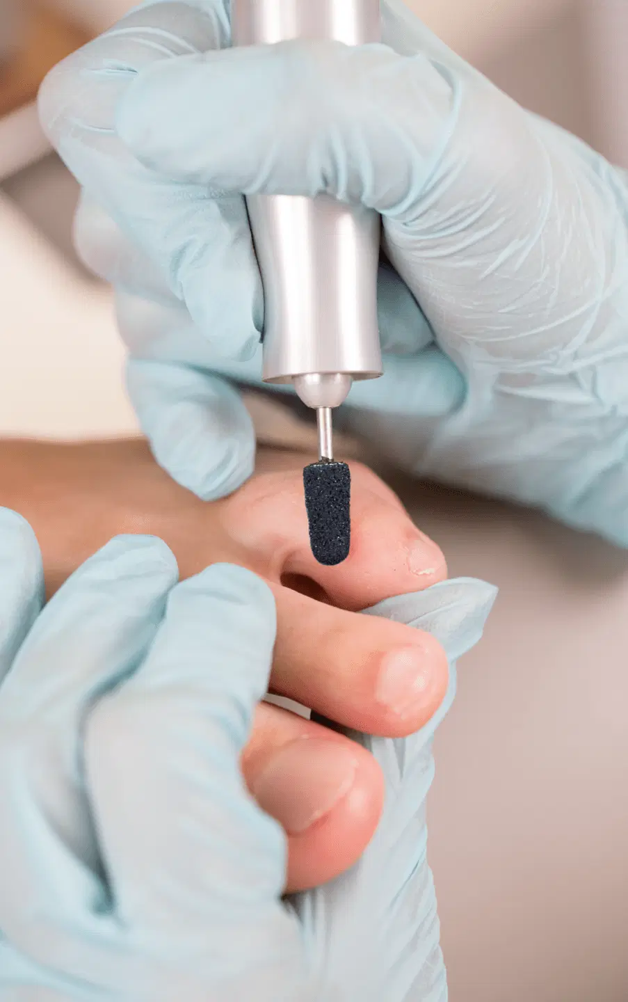 RUCK Schleifkappen, korund-schwarz, fein, rund, Ø 5 mm, 10 Stück