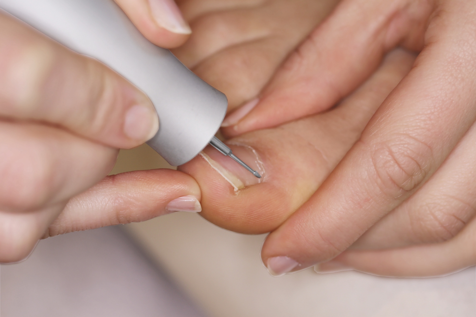 Busch Ony Clean Fräser kurze Form Ø 1,2 mm 2 Stück Busch Ony Clean Fräser kurze Form Ø 1,2 mm 2 Stück